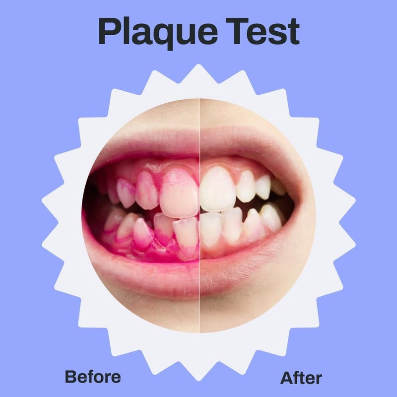 AutoBrush Kids Electric Toothbrush – Only ADA Accepted U-Shaped Toothbrush, Clinically Proven Up to 5.1X Better Cleaning, 30 Seconds, Full-Mouth 360 Coverage, LED Lights, Music, Ages 3-5, Hippo - Image 5